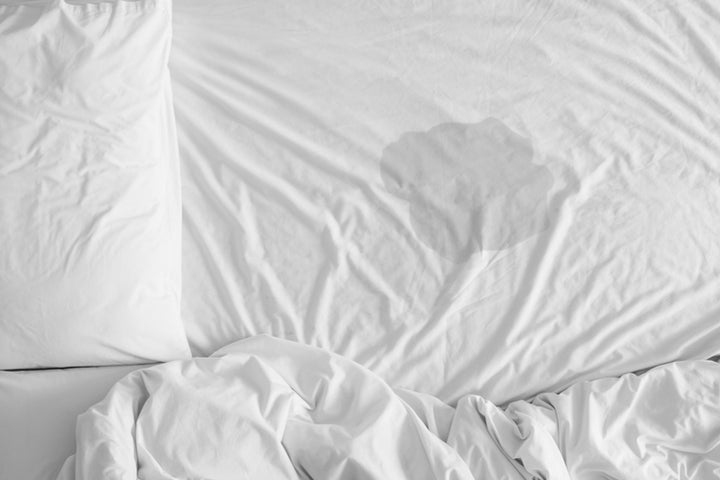 White bedsheets with a wet spot in the middle indicating a night time bladder leak